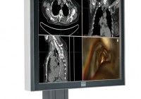 Barco MDRC-2120 Clinical Review Display