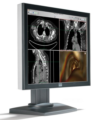  Barco introduces the new MDRC-2120 20-inch clinical review display for 